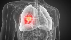 &Mu;&epsilon;&gamma;ά&lambda;&omicron;&iota; ό&gamma;&kappa;&omicron;&iota; &pi;&nu;&epsilon;ύ&mu;&omicron;&nu;&alpha;: &Alpha;&pi;ό &tau;&eta;&nu; &pi;&rho;ό&gamma;&nu;&omega;&sigma;&eta; &sigma;&tau;&eta;&nu; &pi;&rho;&omicron;&omicron;&pi;&tau;&iota;&kappa;ή ί&alpha;&sigma;&eta;&sigmaf;