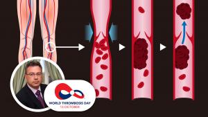 &Pi;&alpha;&gamma;&kappa;ό&sigma;&mu;&iota;&alpha; &Eta;&mu;έ&rho;&alpha; &Theta;&rho;ό&mu;&beta;&omega;&sigma;&eta;&sigmaf;: &Pi;έ&nu;&tau;&epsilon; &phi;&omicron;&rho;έ&sigmaf; &pi;&epsilon;&rho;&iota;&sigma;&sigma;ό&tau;&epsilon;&rho;&epsilon;&sigmaf; &omicron;&iota; &pi;&iota;&theta;&alpha;&nu;ό&tau;&eta;&tau;&epsilon;&sigmaf; &theta;&rho;ό&mu;&beta;&omega;&sigma;&eta;&sigmaf; &gamma;&iota;&alpha; ό&sigma;&omicron;&upsilon;&sigmaf; έ&chi;&omicron;&upsilon;&nu; &kappa;&iota;&rho;&sigma;&omicron;ύ&sigmaf;